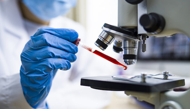 Scientist working with blood sample in laboratory